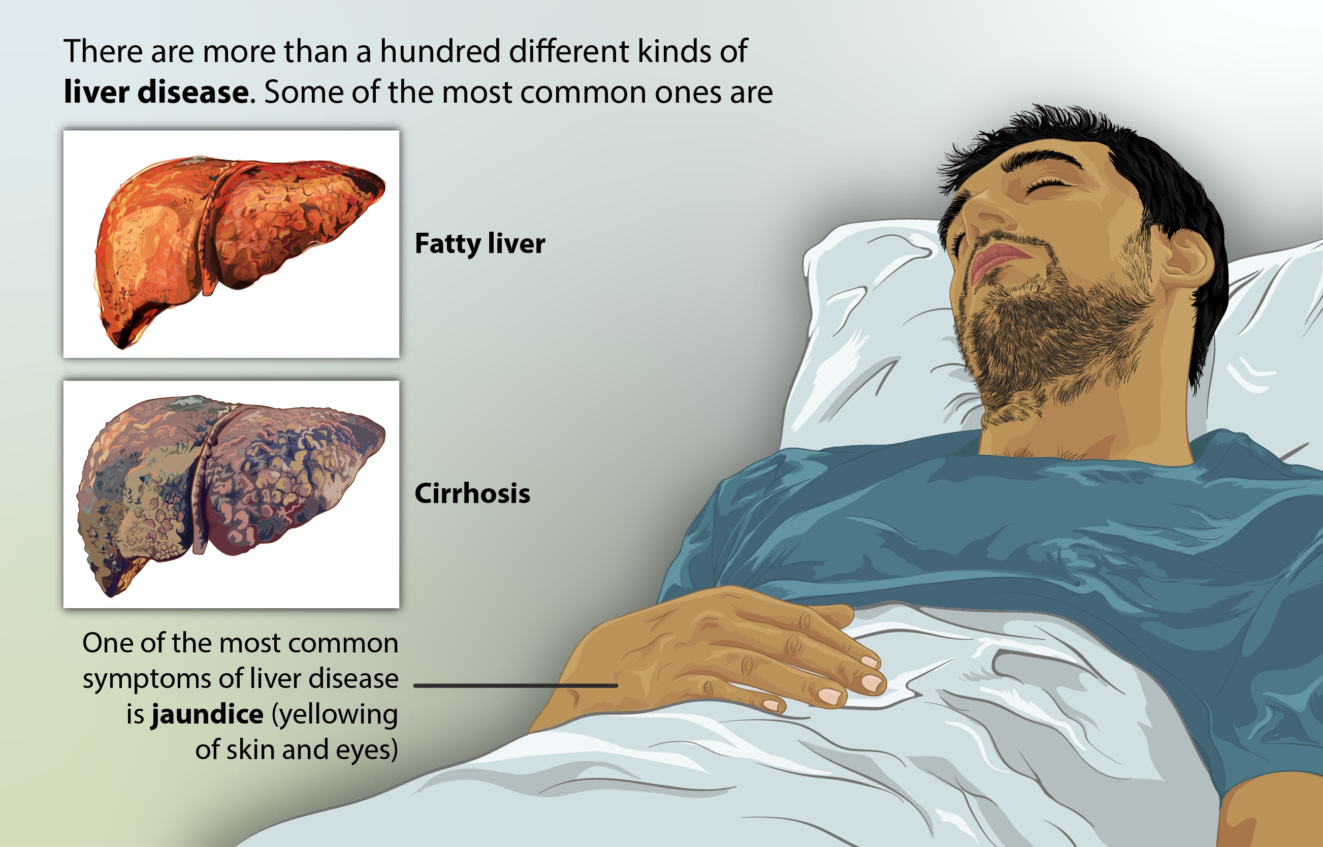 Liver Disease image source: physio-pedia.com